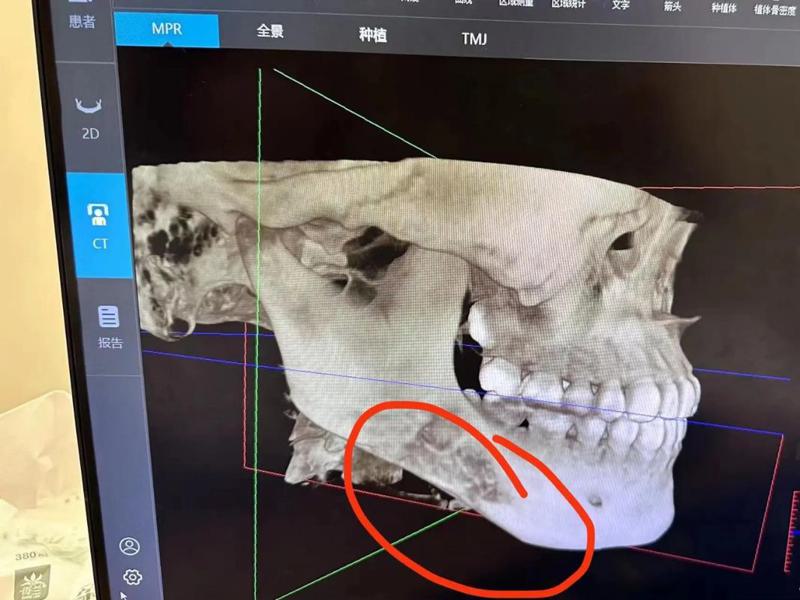 沈阳宝岩整容医院价格费用多少？详细项目费用一览