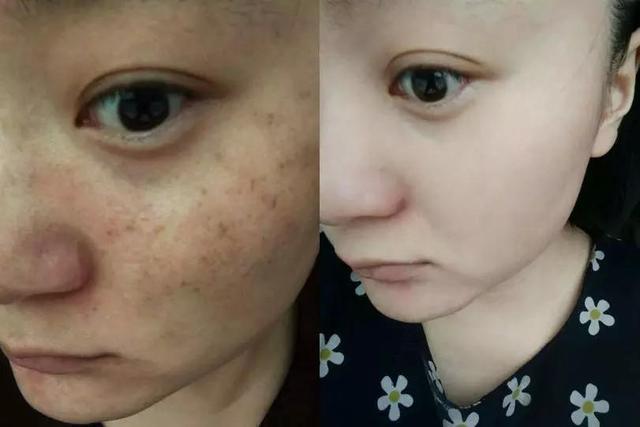 昆明美伊莱与吴氏嘉美哪家技术更优？技术亮点深度解析！信息全览~