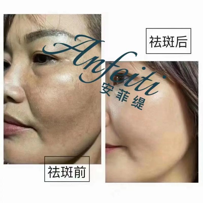 开封市中心医院整形项目价格费用多少？详细清单来啦！