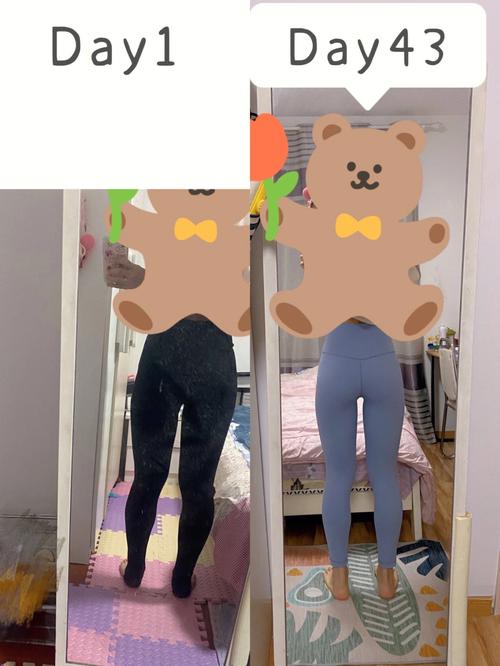 小腿打瘦腿针真的有用吗？价格费用多少曝光！