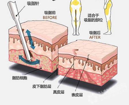 美联臣整形价格大曝光！北京、唐山、石家庄、无锡等地详细价目表