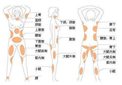 北京自体脂肪隆胸价格曝光及亲身经历分享