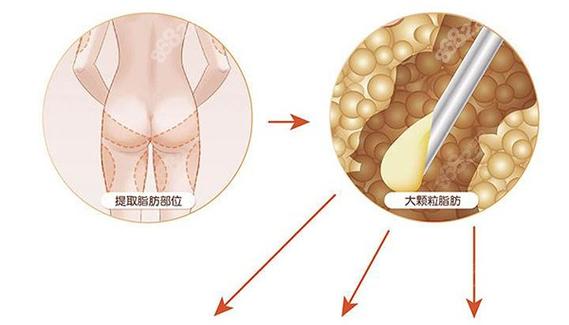 温州和平整形医院整形价格多少钱？详细价格表一览