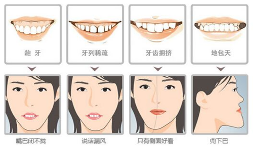 烤瓷牙能用多久？价格费用多少？一文读懂！