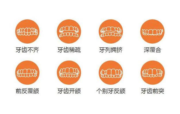 【全力】全新牙套价格表揭晓！马上知道正畸费用！