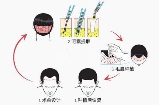 抚顺口碑好的整形医院排名发布，排名前五的实力派机构介绍