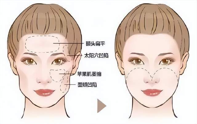 成都时光丽格医疗美容医生哪个好？张春光等实力出类拔萃