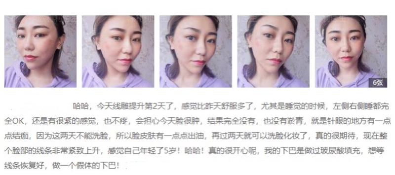 青岛华颜美医疗美容医院医生有哪些？吸脂塑形专家简介-真实案例分享-一键预约!