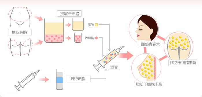 贺韩军眼部整形技术怎么样？坐镇杭州美佳美医疗门诊部，眼部整形案例及医生简介参考
