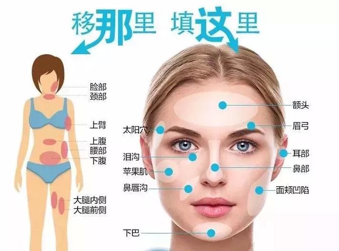 阳江市人民医院整形美容科面部填充技术怎么样？费用及维持时间详解