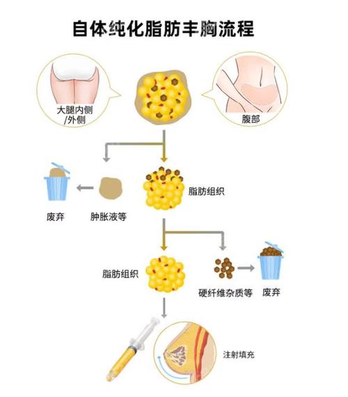 德阳金荣整形医院价目表大曝光，各类整形项目费用一览