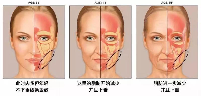 上海南山整形医院技术怎么样？费用一览与术后效果分析