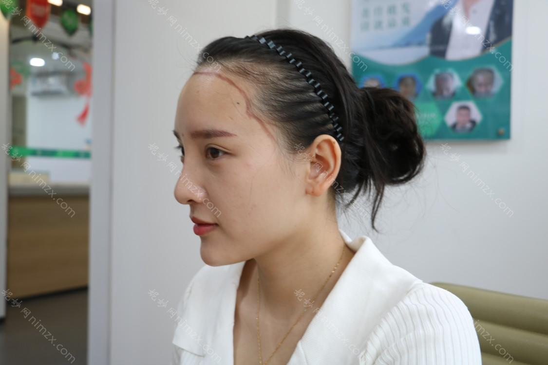 雍禾植发全国连锁