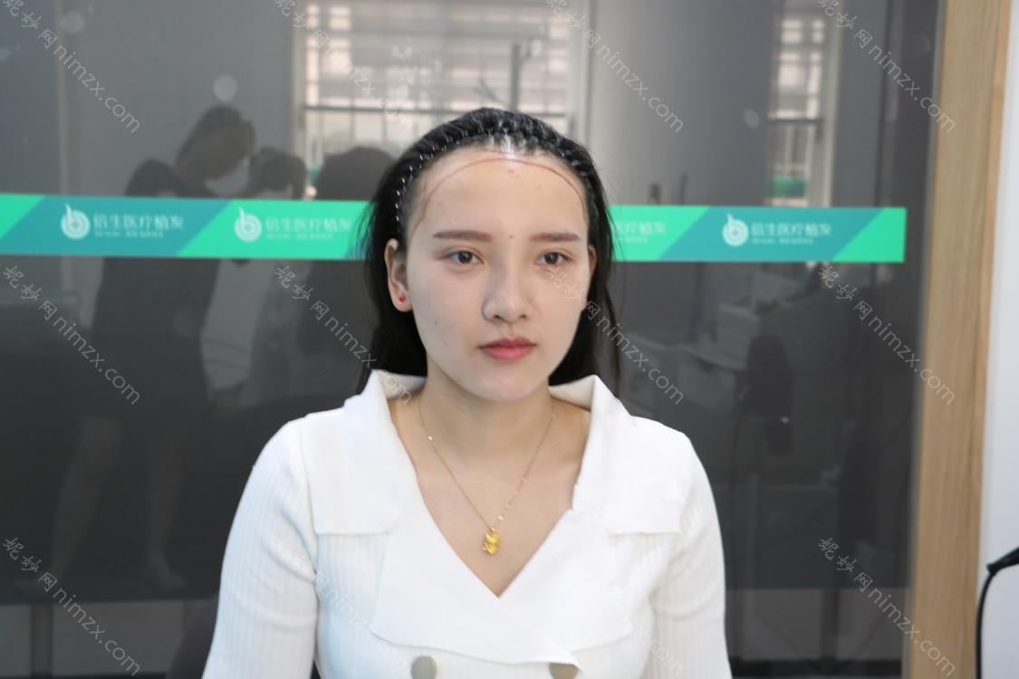 雍禾植发全国连锁
