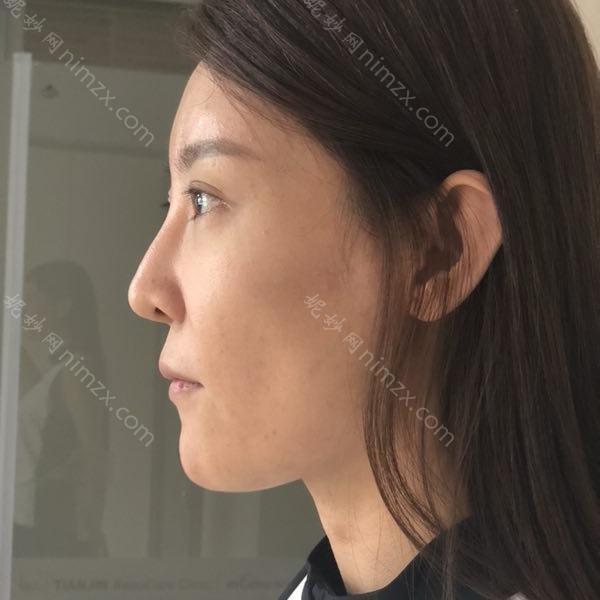 北京加减美
