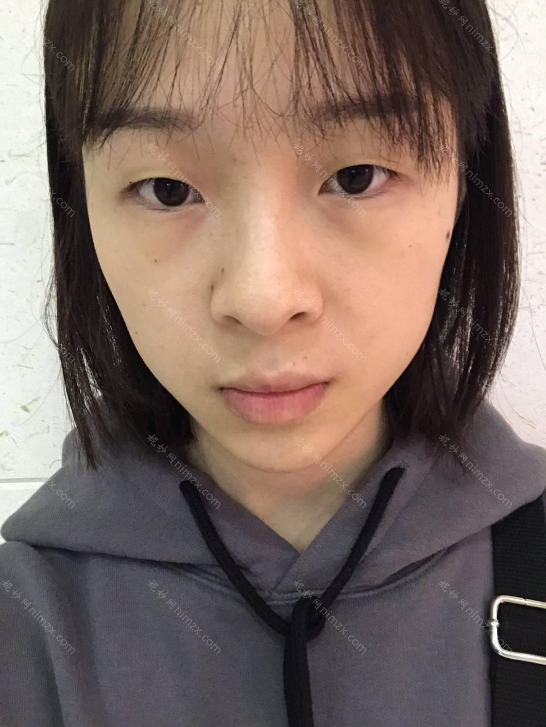 「上海玫瑰医疗美容医院邹功伟」怎么样?擅长|案例|价格表