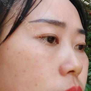 「上海玫瑰医疗美容医院邹功伟」怎么样?擅长|案例|价格表