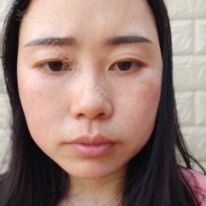 「上海玫瑰医疗美容医院邹功伟」怎么样?擅长|案例|价格表