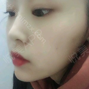「北京基恩医院整形美容科」怎么样?正规吗|案例|价格表