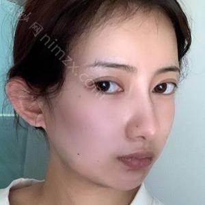 「北京基恩医院整形美容科金泳洙」怎么样?擅长|案例|价格表