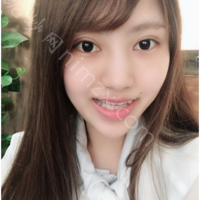 「上海愉悦美联臣医疗美容医院陈红梅」怎么样?擅长|案例|价格表