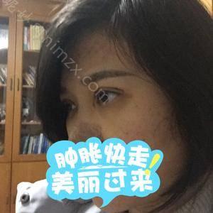 「北京协和医院整形科」怎么样?正规吗|案例|价格表