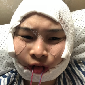 「北京协和医院整形科曾昂」怎么样?擅长|案例|价格表