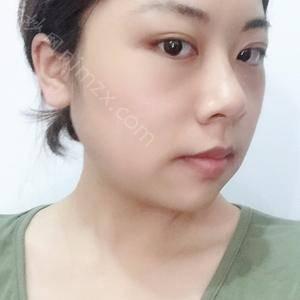 「石家庄雅芳亚整形医疗美容医院贾美乐」怎么样?擅长|案例|价格表