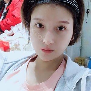 「郑州羽中整形医疗美容诊所朱自刚」怎么样?擅长|案例|价格表|