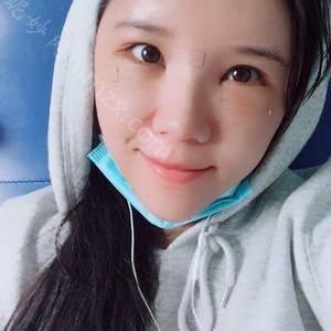 「郑州羽中整形医疗美容诊所刘海燕」怎么样?擅长|案例|价格表