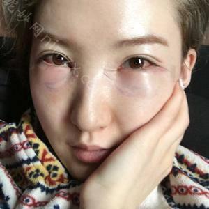 「郑州羽中整形医疗美容诊所温艳玲」怎么样?擅长|案例|价格表