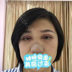 「北京协和医院整形科」怎么样?正规吗|案例|价格表