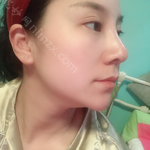 「中国医学科学院北京协和医院整形外科(西院)龙笑」怎么样?擅长|案例|价格表
