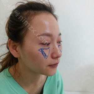 「北京清菡聚美医疗美容诊所秦国萍」怎么样?擅长|案例|价格表