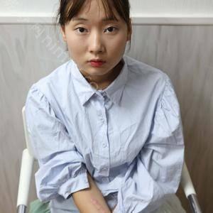 「北京圣嘉新医疗美容医院邱立东」怎么样?擅长|案例|价格表