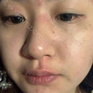 「石家庄雅芳亚医疗美容医院刘桂臻」怎么样?擅长|案例|价格表||
