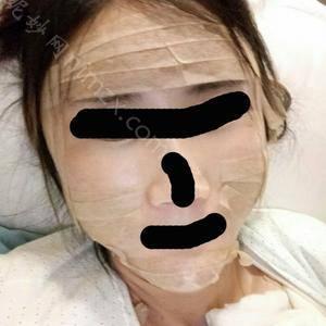 「中国医学科学院整形外科医院（北京八大处整形医院)」怎么样?正规吗|案例|价格表