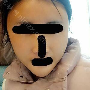 「中国医学科学院整形外科医院（北京八大处整形医院)」怎么样?正规吗|案例|价格表