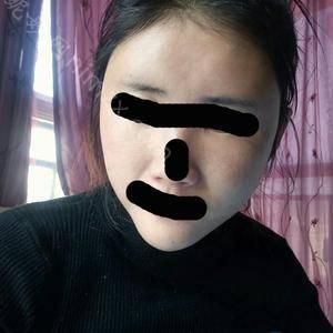 「中国医学科学院整形外科医院（北京八大处整形医院)」怎么样?正规吗|案例|价格表