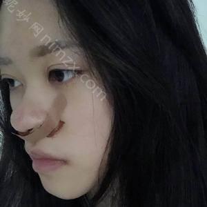 「上海喜美医疗美容门诊部金伟中」怎么样?擅长|案例|价格表