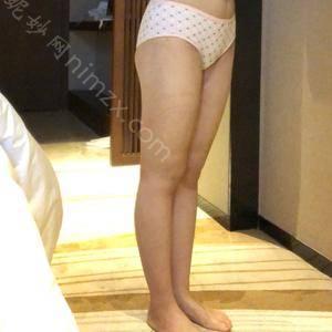 「长沙爱思特医疗美容有限公司长沙爱思特医疗美容医院瞿安康」怎么样?擅长|案例|价格表