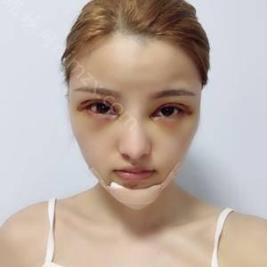 「北京协和医院整形外科」怎么样?正规吗|案例|价格表