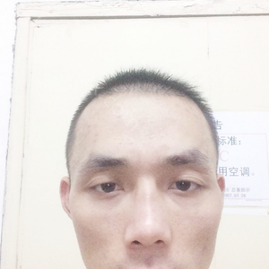 「中国医学科学院整形外科医院（北京八大处整形医院)解芳」怎么样?擅长|案例|价格表