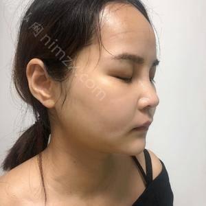 「重庆时光整形美容医院」怎么样?正规吗|案例|价格表