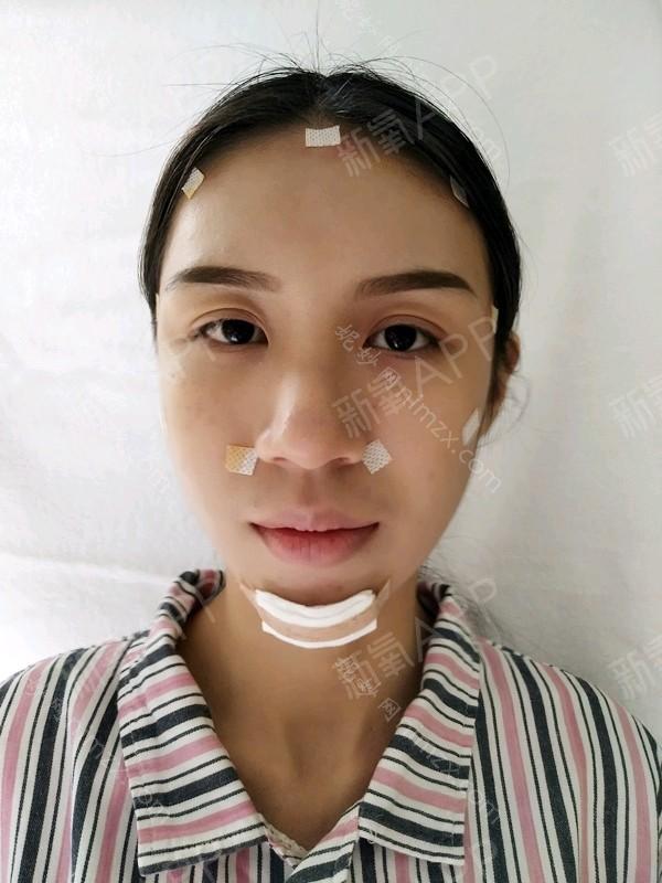 「重庆艺星医疗美容医院」怎么样?正规吗|案例|价格表