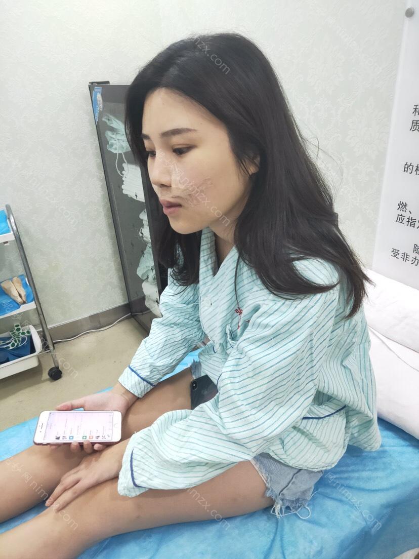 「郑州天美医疗美容 」怎么样?正规吗|案例|价格表