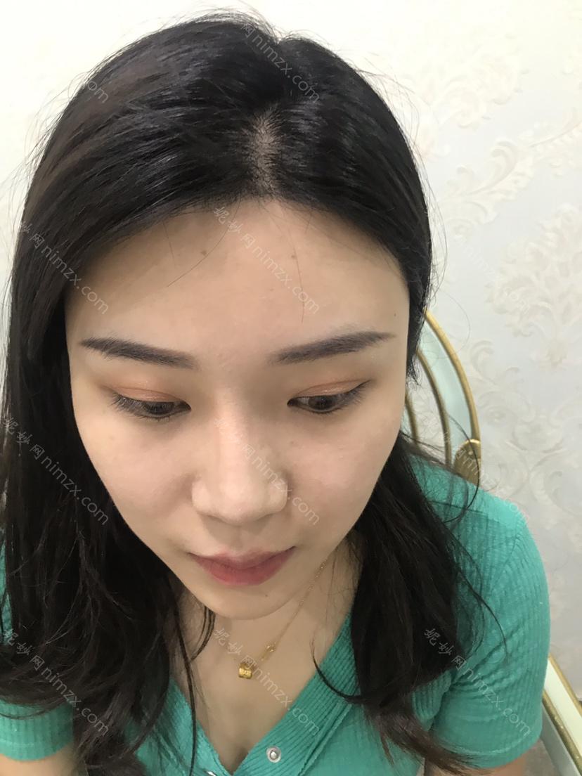「郑州天美医疗美容 」怎么样?正规吗|案例|价格表