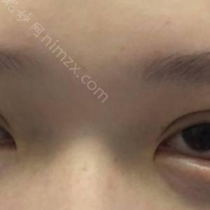 天津哪家医院做下眼下至术比较好？排名前五口碑医院盘点_河东菲丝澜、红桥同健实力入围！