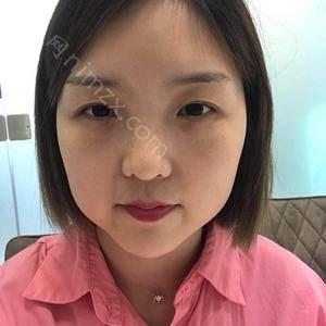 天津哪家医院做下眼下至术比较好？排名前五口碑医院盘点_河东菲丝澜、红桥同健实力入围！