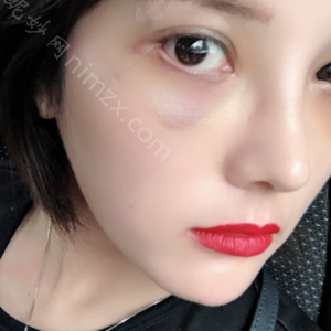 天津哪家医院做下眼下至术比较好？排名前五口碑医院盘点_河东菲丝澜、红桥同健实力入围！
